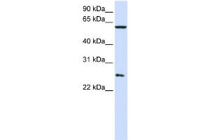 WB Suggested Anti-CCT7  Antibody Titration: 0. (CCT7 Antikörper  (Middle Region))