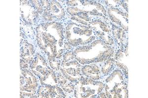 Immunohistochemistry (IHC) image for anti-Macrophage Migration Inhibitory Factor (Glycosylation-Inhibiting Factor) (MIF) (AA 2-115) antibody (ABIN7449455)