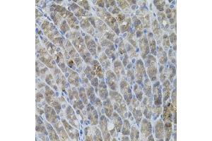 Immunohistochemistry of paraffin-embedded mouse stomach using UBE2A antibody (ABIN6132760, ABIN6149782, ABIN6149784 and ABIN6223686) (40x lens). (UBE2A Antikörper  (AA 1-152))