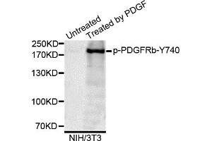 Western blot analysis of extracts of NIH/3T3 cells, using Phospho-PDGFRb-Y740 antibody. (PDGFRB Antikörper)