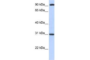 WB Suggested Anti-ANKRA2 Antibody Titration:  0. (ANKRA2 Antikörper  (C-Term))