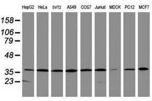 Image no. 3 for anti-Apurinic/Apyrimidinic Endonuclease 1 (APEX1) (AA 1-242) antibody (ABIN1490626) (APEX1 Antikörper  (AA 1-242))