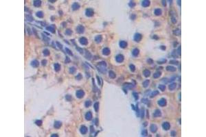 IHC-P analysis of Human Tissue, with DAB staining. (SLC2A14 Antikörper  (AA 51-105))