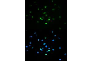 Immunofluorescence analysis of MCF-7 cells using TP53 antibody (ABIN5971632). (p53 Antikörper)