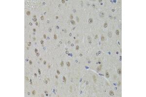Immunohistochemistry (Paraffin-embedded Sections) (IHC (p)) image for anti-DEAD (Asp-Glu-Ala-Asp) Box Polypeptide 1 (DDX1) (AA 441-740) antibody (ABIN6139477)