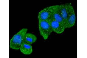 Hela cells were stained with Smad2 (9A3) Monoclonal Antibody  at [1:200] incubated for overnight at 4C followed by secondary antibody incubation, DAPI staining of the nuclei and detection. (SMAD2 Antikörper)