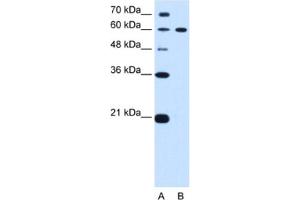 Western Blotting (WB) image for anti-Deltex Homolog 2 (DTX2) antibody (ABIN2462679) (DTX2 Antikörper)