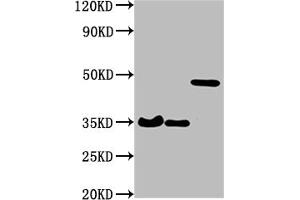 Western Blot Positive WB detected in: 3 different overexpression lysates with HA tagged All lanes: HA-Tag antibody at 1:1000 Secondary Goat polyclonal to Mouse IgG at 1/10000 dilution Predicted band size: 35, 35, 48 kDa Observed band size: 35, 35, 48 kDa (HA-Tag Antikörper)