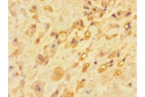 Immunohistochemistry of paraffin-embedded human placenta tissue using ABIN7146737 at dilution of 1:100 (CA11 Antikörper  (AA 24-328))
