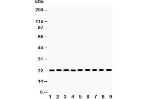 Western blot testing of PRDX1 antibody and Lane 1:  rat brain;  2: mouse brain;  3: human U87;  4: (m) Neuro-2a;  5: (h) A375;  6: (h) 293T;  7: (h) SMMC;  8: (h) A549;  9: (h) RH35 lysate. (Peroxiredoxin 1 Antikörper  (Middle Region))