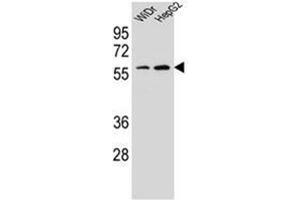 Western blot analysis of HOXA10 / HOX1H Antibody (Center) in WiDr, HepG2 cell line lysates (35ug/lane).