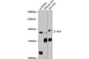Western blot analysis of extracts of various cell lines, using PZP antibody (ABIN1682416, ABIN3017699, ABIN3017700 and ABIN6220213) at 1:3000 dilution. (PZP Antikörper  (AA 620-740))