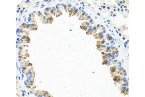 Immunohistochemistry of paraffin-embedded Mouse lung using GNRH2 Polyclonal Antibody at dilution of 1:100 (40x lens). (GnRH2 Antikörper)