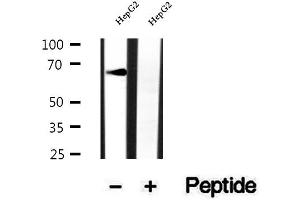Western blot analysis of extracts of HepG2 cells, using RNF156 antibody. (Mahogunin RING Finger Protein 1 Antikörper  (Internal Region))