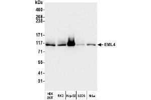 Western Blotting (WB) image for anti-Echinoderm Microtubule Associated Protein Like 4 (EML4) (AA 931-981) antibody (ABIN7454794) (EML4 Antikörper  (AA 931-981))