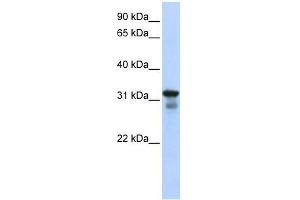 LAPTM4B antibody used at 1 ug/ml to detect target protein. (LAPTM4B Antikörper  (Middle Region))