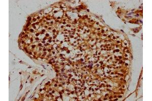 IHC image of ABIN7176072 diluted at 1:300 and staining in paraffin-embedded human testis tissue performed on a Leica BondTM system.