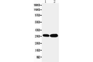 Anti-LASP1 antibody, Western blotting Lane 1: HELA Cell Lysate Lane 2: MCF-7 Cell Lysate