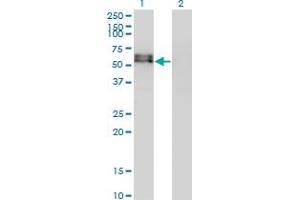 Western Blotting (WB) image for anti-Activin Receptor Type I (ACRV1) (AA 21-120) antibody (ABIN513099)