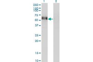 Western Blot analysis of ACVR1 expression in transfected 293T cell line by ACVR1 monoclonal antibody (M07), clone 2D5. (ACVR1 Antikörper  (AA 21-120))