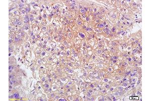 L1 human colon carcinoma lysates L2 rat brain lysates probed with Anti GPR15 Polyclonal Antibody, Unconjugated (ABIN702835) at 1:200 overnight at 4 °C. (GPR15 Antikörper  (AA 51-150))