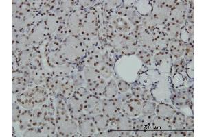 Immunoperoxidase of monoclonal antibody to SAFB on formalin-fixed paraffin-embedded human salivary gland. (SAFB Antikörper  (AA 111-200))