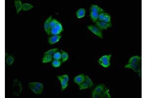 Immunofluorescence staining of PC-3 cells with ABIN7155709 at 1:33, counter-stained with DAPI. (Homeobox A11 Antikörper  (AA 115-176))