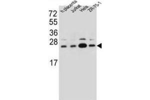 Western Blotting (WB) image for anti-Signal Sequence Receptor, beta (Translocon-Associated Protein Beta) (SSR2) antibody (ABIN2997190) (SSR2 Antikörper)
