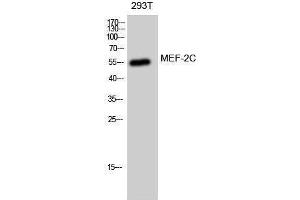 Western Blotting (WB) image for anti-Myocyte Enhancer Factor 2C (MEF2C) (Ser893) antibody (ABIN3185513) (MEF2C Antikörper  (Ser893))