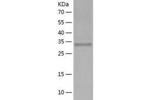 Western Blotting (WB) image for Ribosomal Protein, Large, P0 (RPLP0) (AA 1-317) protein (His tag) (ABIN7124909) (RPLP0 Protein (AA 1-317) (His tag))