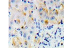 Used in DAB staining on fromalin fixed paraffin-embedded Liver tissue (Oncostatin M Receptor Antikörper  (AA 503-749))