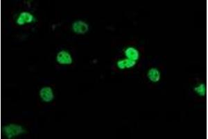 Anti-UBA2 mouse monoclonal antibody (ABIN2454287) immunofluorescent staining of COS7 cells transiently transfected by pCMV6-ENTRY UBA2 (RC201288). (UBA2 Antikörper)