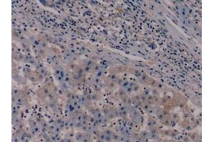 Immunohistochemistry (IHC) image for anti-Nestin (NES) (AA 178-399) antibody (ABIN7426685)