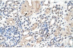 Rabbit Anti-NCL Antibody Catalog Number: ARP40583 Paraffin Embedded Tissue: Human Kidney Cellular Data: Epithelial cells of renal tubule Antibody Concentration: 4. (Nucleolin Antikörper  (N-Term))