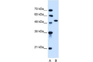 WB Suggested Anti-ACVR1 Antibody Titration:  0. (ACVR1 Antikörper  (N-Term))