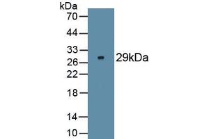 Detection of Recombinant FOXP3, Human using Monoclonal Antibody to Forkhead Box P3 (FOXP3) (FOXP3 Antikörper  (AA 191-412))