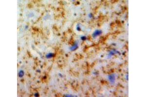 IHC-P analysis of Brain tissue, with DAB staining. (PLAUR Antikörper  (AA 221-305))