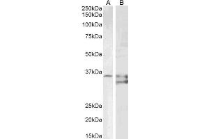 ABIN6391386 (1ug/ml) staining of PD19 (A) and (2µg/ml) K562 (B) cell lysate (35µg protein in RIPA buffer). (SGTA Antikörper  (AA 84-97))