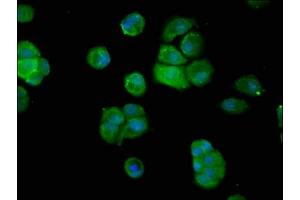 Immunofluorescence staining of MCF-7 cells with ABIN7144753 at 1:200, counter-stained with DAPI. (Aspartyl Aminopeptidase Antikörper  (AA 279-386))