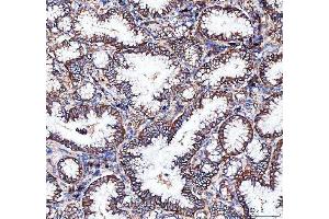 IHC analysis of Integrin alpha 3/ITGA3 using anti-Integrin alpha 3/ITGA3 antibody (ABIN7602696). (ITGA3 Antikörper  (AA 96-324))