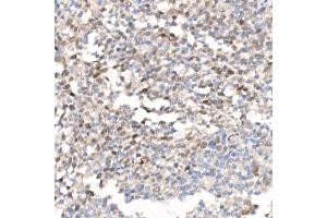 Immunohistochemistry (IHC) image for anti-Baculoviral IAP Repeat-Containing 5 (BIRC5) (AA 1-142) antibody (ABIN6137562)