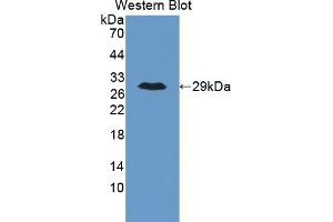 Figure. (ANGPTL6 Antikörper  (AA 238-457))