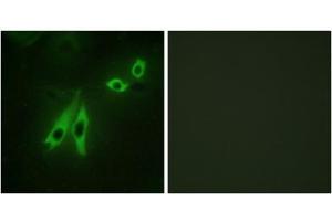 Immunofluorescence analysis of NIH/3T3 cells, using AKAP3 antibody. (AKAP3 Antikörper  (Internal Region))
