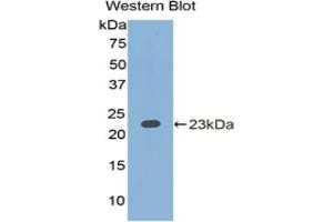 Western blot analysis of the recombinant protein. (IL1A Antikörper  (AA 90-268))