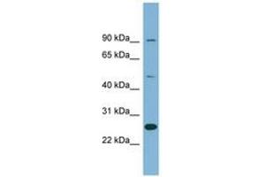 Image no. 1 for anti-Leucine Rich Repeat Containing 49 (LRRC49) (AA 35-84) antibody (ABIN6742052) (LRRC49 Antikörper  (AA 35-84))