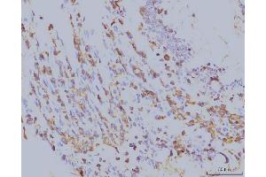 IHC analysis of EIF4A1 using anti-EIF4A1 antibody (ABIN7603144).
