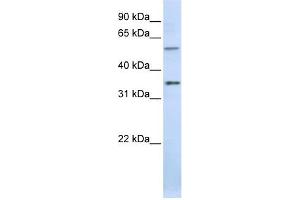 TJAP1 antibody used at 1 ug/ml to detect target protein. (TJAP1 Antikörper)