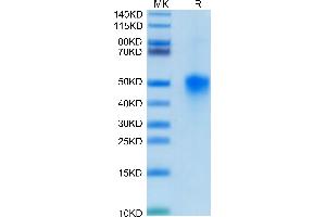SDS-PAGE (SDS) image for Tumor-Associated Calcium Signal Transducer 2 (TACSTD2) (AA 25-270) protein (His tag) (ABIN7275797)