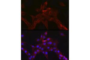 Immunofluorescence analysis of PC-12 cells using nNOS Rabbit mAb (ABIN1680436, ABIN1680435, ABIN7101483 and ABIN7101484) at dilution of 1:100 (40x lens). (NOS1 Antikörper)
