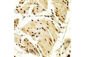 Immunohistochemistry of paraffin-embedded Human esophageal using NFATC1 antibody at dilution of 1:100 (x400 lens). (NFATC1 Antikörper  (AA 20-300))